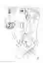 Fig. 02 - Multiple LED sensors on a fiberoptic cable used as a catheter