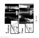 Fig. 07 - Methods and apparatus for accelerated, motion-corrected high-resolution MRI employing internal detectors or MRI endoscopy