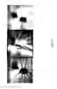 Fig. 08 - Methods and apparatus for accelerated, motion-corrected high-resolution MRI employing internal detectors or MRI endoscopy