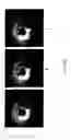 Fig. 09 - Methods and apparatus for accelerated, motion-corrected high-resolution MRI employing internal detectors or MRI endoscopy