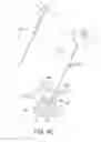 Fig. 09 - Method for balloon-assisted augmentation and fusion of adjacent vertebral bodies