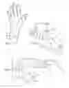 Fig. 02 - GLOVE WITH REMOVAL TAB