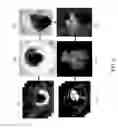 Fig. 07 - System and method for structure-function fusion for surgical interventions
