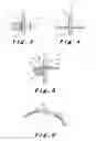 Fig. 03 - Dentist tool