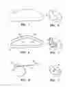 Fig. 02 - Tissue marking implant