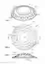 Fig. 02 - REVERSIBLY DEFORMABLE ARTIFICIAL CORNEA AND METHODS FOR IMPLANTATION