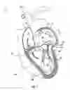 Fig. 02 - Double orifice device for transcatheter mitral valve replacement