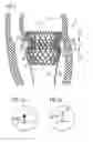 Fig. 02 - Transcatheter valve prosthesis