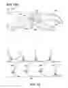 Fig. 15 - ELECTRONICALLY CONTROLLED PROSTHETIC SYSTEM