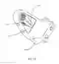 Fig. 30 - Arm prosthetic device