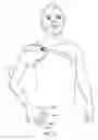 Fig. 65 - Arm prosthetic device