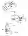 Fig. 75 - Arm prosthetic device