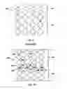 Fig. 06 - Crimping method for bioresorbable stents