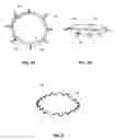 Fig. 05 - INDWELLING BODY LUMEN EXPANDER