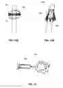 Fig. 10 - INDWELLING BODY LUMEN EXPANDER