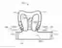 Fig. 01 - System, method, and device for posture support