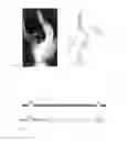 Fig. 02 - Methods and apparatuses for the external distraction in the assistance of spinal deformities