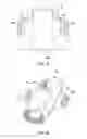 Fig. 04 - Infant patient transfer device
