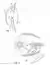 Fig. 02 - Debris clearance system for an ocular implant