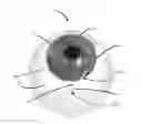 Fig. 01 - Methods, systems and devices for treating glaucoma