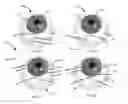 Fig. 06 - Methods, systems and devices for treating glaucoma