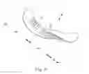 Fig. 04 - Sanitary napkins capable of taking complex three-dimensional shape in use