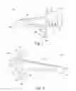Fig. 02 - ABDOMINAL SUPPORT APPARATUS
