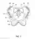 Fig. 02 - Post-Pregnancy Hip Compression Garment