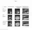 Fig. 02 - INJECTABLE STERILE AQUEOUS FORMULATION BASED ON CROSSLINKED HYALURONIC ACID AND HYDROXYAPATITE FOR AESTHETIC USE