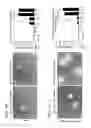 Fig. 04 - Compositions and methods for promoting intestinal stem cell function