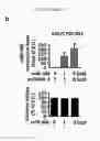 Fig. 08 - COMPOSITIONS FOR MODULATING INVASION ABILITY OF A TUMOR AND METHODS THEREOF