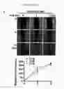 Fig. 09 - COMPOSITIONS FOR MODULATING INVASION ABILITY OF A TUMOR AND METHODS THEREOF