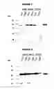 Fig. 02 - BACTERIAL OUTER MEMBRANE VESICLES