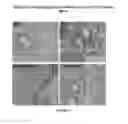 Fig. 22 - COMPOSITIONS AND METHODS FOR PREVENTING OR TREATING CHRONIC LUNG ALLOGRAFT DYSFUNCTION (CLAD) AND IDIOPATHIC PULMONARY FIBROSIS (IPF)