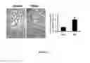 Fig. 35 - COMPOSITIONS AND METHODS FOR PREVENTING OR TREATING CHRONIC LUNG ALLOGRAFT DYSFUNCTION (CLAD) AND IDIOPATHIC PULMONARY FIBROSIS (IPF)