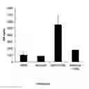 Fig. 43 - COMPOSITIONS AND METHODS FOR PREVENTING OR TREATING CHRONIC LUNG ALLOGRAFT DYSFUNCTION (CLAD) AND IDIOPATHIC PULMONARY FIBROSIS (IPF)