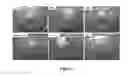 Fig. 02 - PRESSURE-SENSITIVE HYDROGEL AND METHOD OF USE
