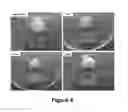 Fig. 09 - PRESSURE-SENSITIVE HYDROGEL AND METHOD OF USE