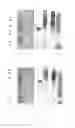 Fig. 04 - Combined enteropathogen recombinant construct