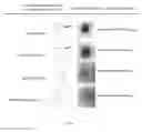 Fig. 09 - Combined enteropathogen recombinant construct