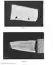 Fig. 02 - COMPOSITION AND METHOD OF PREPARATION OF BONE ALLOGRAFT FROM ENDOSTEAL PORTION OF BONE AND ISOLATED BONE PERIOSTEUM
