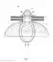 Fig. 02 - Percutaneous system, devices and methods