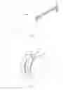 Fig. 05 - Tool and method for inserting an endotracheal tube