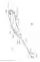 Fig. 02 - Method of performing a sphenopalatine ganglion block procedure