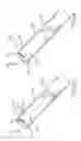 Fig. 47 - Medical device for removing an implanted object