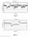 Fig. 02 - Methods and systems for controlling blood pressure by controlling atrial pressure