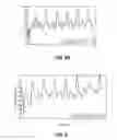 Fig. 05 - Methods and systems for controlling blood pressure by controlling atrial pressure