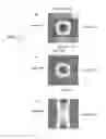 Fig. 04 - Ultrasonic sensor