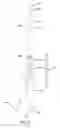 Fig. 08 - Concrete anchor driver tool