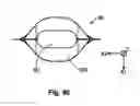 Fig. 47 - Liquid container and filling method